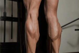 calves